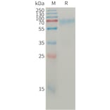 SDS-PAGE - Recombinant Human Angiopoietin 2/ANG2 Protein (6×His Tag) (A317764) - Antibodies.com