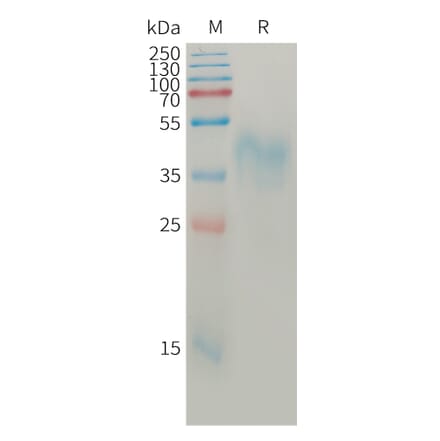 SDS-PAGE - Recombinant Human BTN2A1 Protein (6×His Tag) (A317765) - Antibodies.com