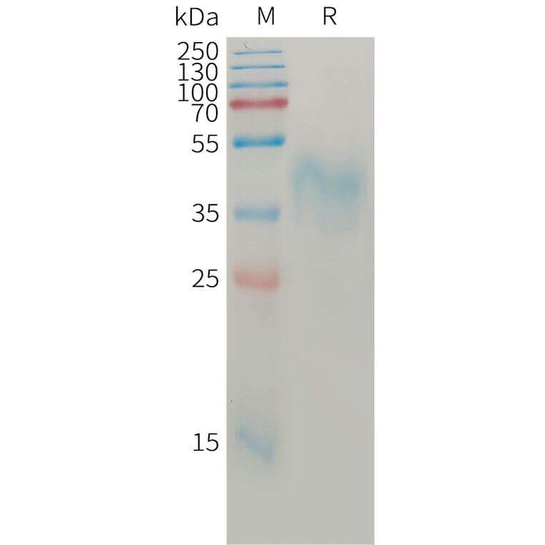 SDS-PAGE - Recombinant Human BTN2A1 Protein (6×His Tag) (A317765) - Antibodies.com