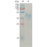 SDS-PAGE - Recombinant Human BTN2A1 Protein (6×His Tag) (A317765) - Antibodies.com