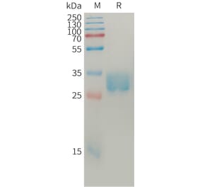 SDS-PAGE - Recombinant Human SLAMF8 Protein (6×His Tag) (A317766) - Antibodies.com