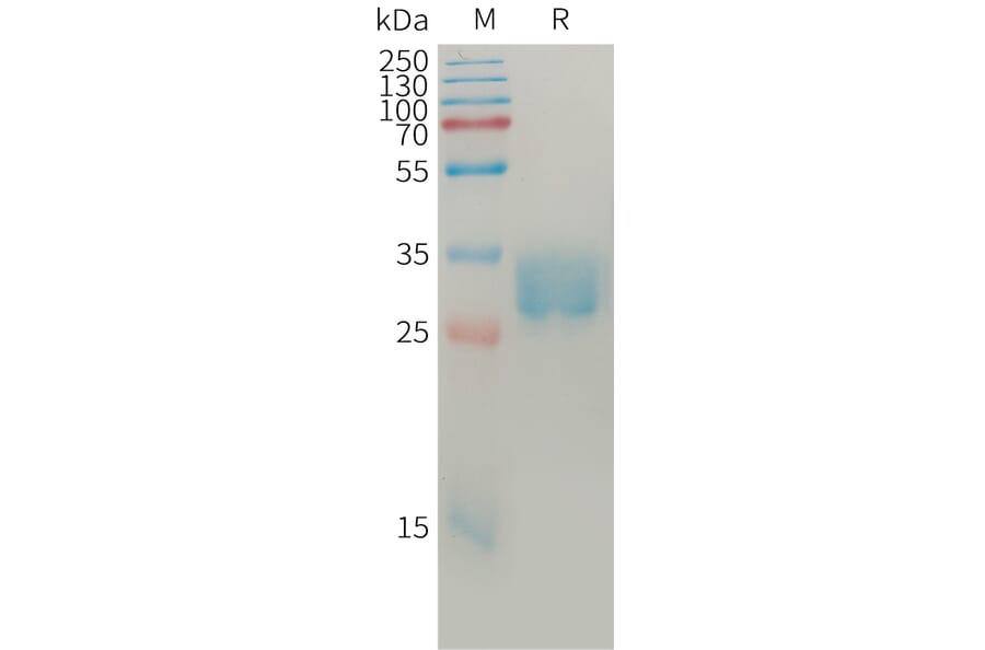 SDS-PAGE - Recombinant Human SLAMF8 Protein (6×His Tag) (A317766) - Antibodies.com