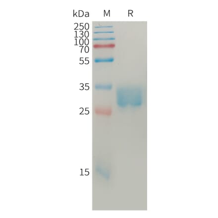 SDS-PAGE - Recombinant Human SLAMF8 Protein (6×His Tag) (A317766) - Antibodies.com