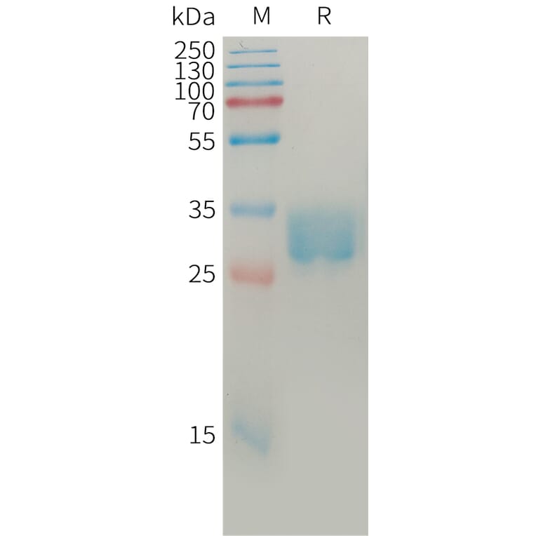 SDS-PAGE - Recombinant Human SLAMF8 Protein (6×His Tag) (A317766) - Antibodies.com