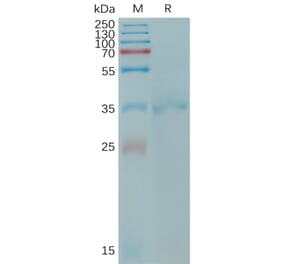 SDS-PAGE - Recombinant Human Claudin 6 Protein (Fc Tag) (A317768) - Antibodies.com