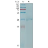 SDS-PAGE - Recombinant Human Claudin 6 Protein (Fc Tag) (A317768) - Antibodies.com
