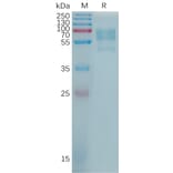 SDS-PAGE - Recombinant Human SynCAM/CADM1 Protein (6×His Tag) (A317769) - Antibodies.com