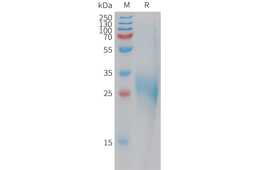 SDS-PAGE - Recombinant Human CLEC-2 Protein (6×His Tag) (A317770) - Antibodies.com
