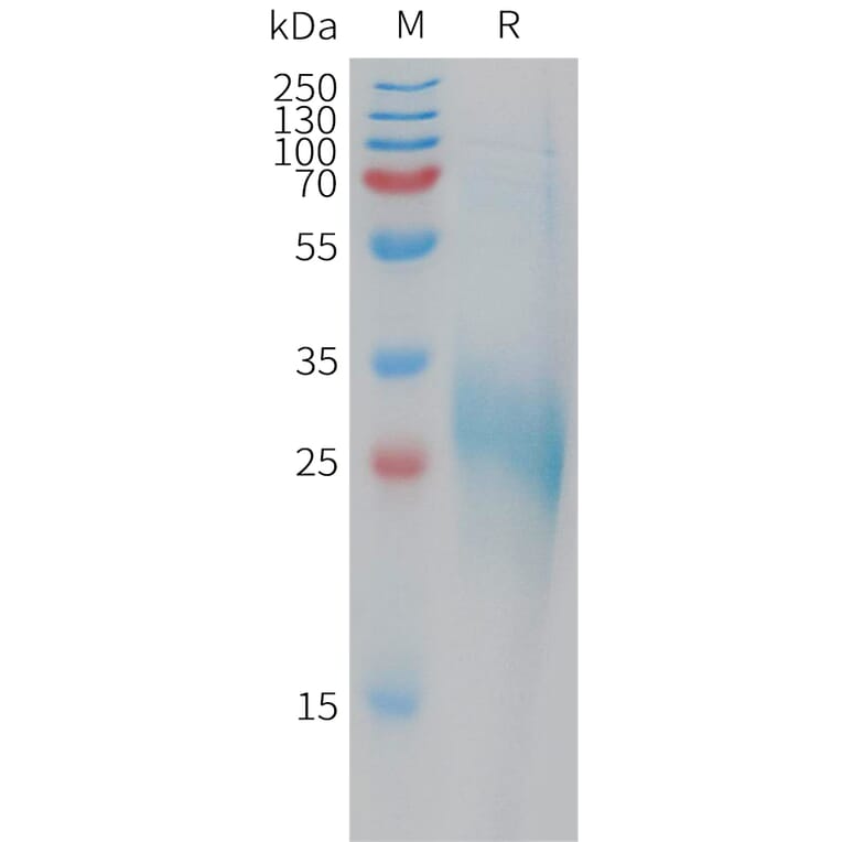 SDS-PAGE - Recombinant Human CLEC-2 Protein (6×His Tag) (A317770) - Antibodies.com