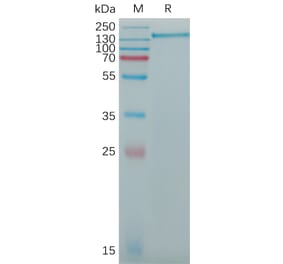 SDS-PAGE - Recombinant Human CD163 Protein (6×His Tag) (A317773) - Antibodies.com