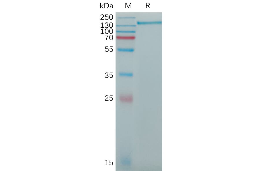 SDS-PAGE - Recombinant Human CD163 Protein (6×His Tag) (A317773) - Antibodies.com