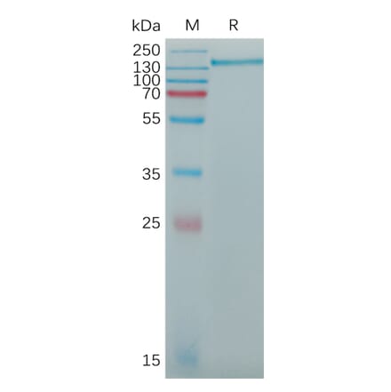 SDS-PAGE - Recombinant Human CD163 Protein (6×His Tag) (A317773) - Antibodies.com