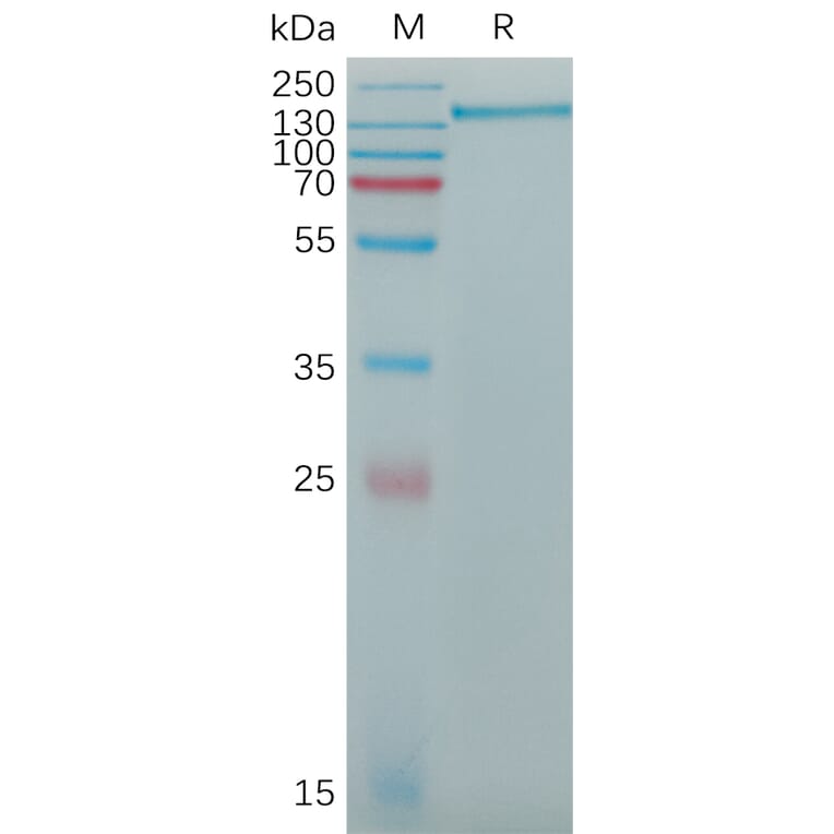 SDS-PAGE - Recombinant Human CD163 Protein (6×His Tag) (A317773) - Antibodies.com