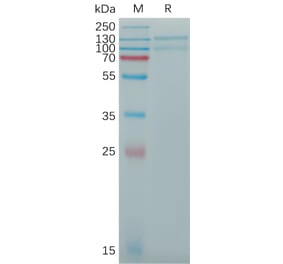 SDS-PAGE - Recombinant Human LDL Receptor Protein (6×His Tag) (A317774) - Antibodies.com