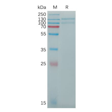 SDS-PAGE - Recombinant Human LDL Receptor Protein (6×His Tag) (A317774) - Antibodies.com