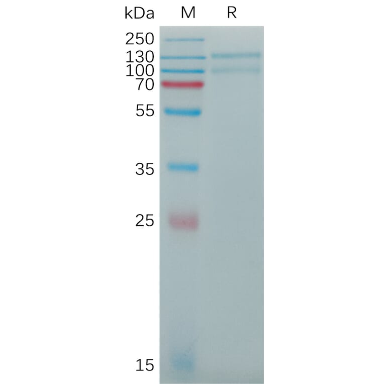 SDS-PAGE - Recombinant Human LDL Receptor Protein (6×His Tag) (A317774) - Antibodies.com