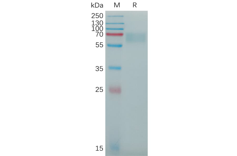 SDS-PAGE - Recombinant Human alpha 2 Antiplasmin Protein (6×His Tag) (A317775) - Antibodies.com