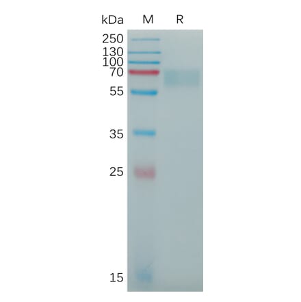 SDS-PAGE - Recombinant Human alpha 2 Antiplasmin Protein (6×His Tag) (A317775) - Antibodies.com