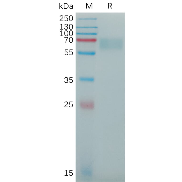SDS-PAGE - Recombinant Human alpha 2 Antiplasmin Protein (6×His Tag) (A317775) - Antibodies.com