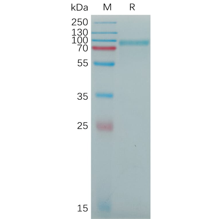 SDS-PAGE - Recombinant Human SEMAC Protein (6×His Tag) (A317776) - Antibodies.com