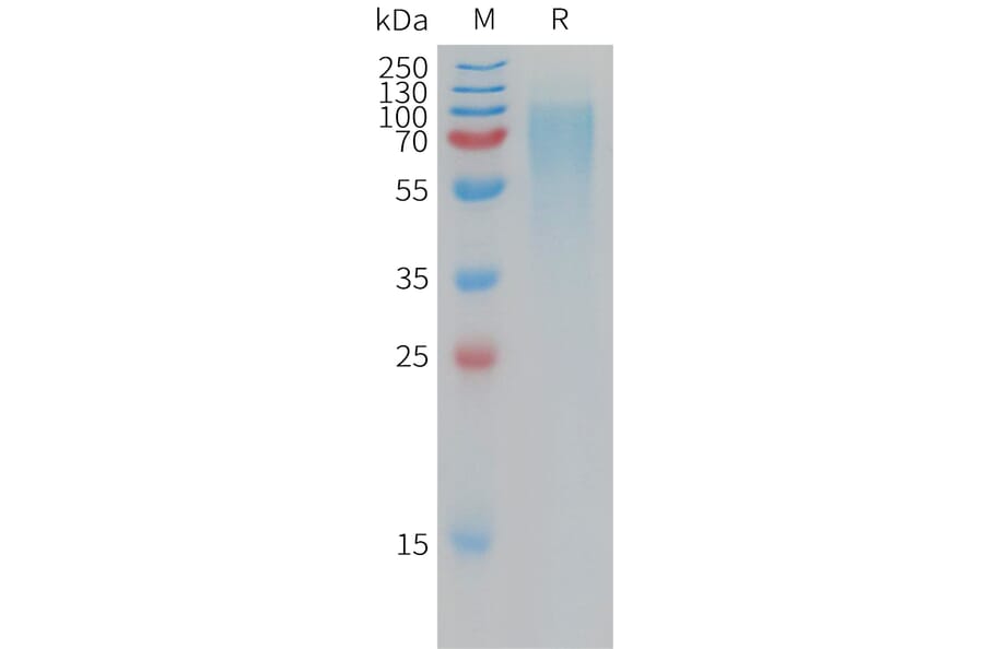 SDS-PAGE - Recombinant Human NPR-B Protein (6×His Tag) (A317777) - Antibodies.com