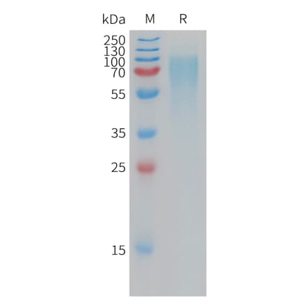 SDS-PAGE - Recombinant Human NPR-B Protein (6×His Tag) (A317777) - Antibodies.com
