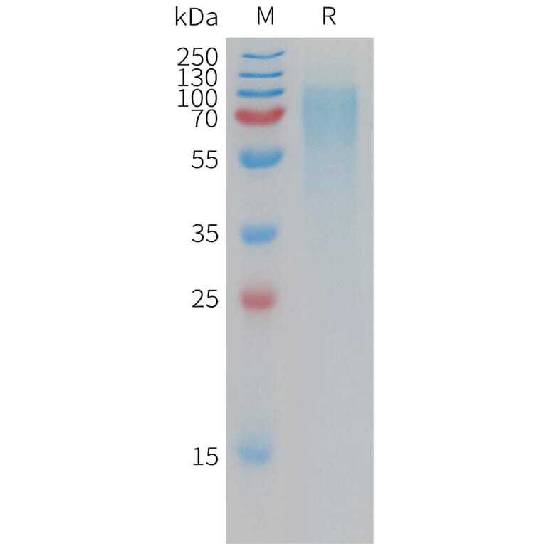 SDS-PAGE - Recombinant Human NPR-B Protein (6×His Tag) (A317777) - Antibodies.com