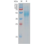 SDS-PAGE - Recombinant Human VSTM5 Protein (Fc Tag) (A317778) - Antibodies.com