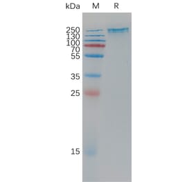 SDS-PAGE - Recombinant Human Sez6 Protein (6×His Tag) (A317779) - Antibodies.com