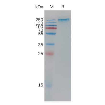 SDS-PAGE - Recombinant Human Sez6 Protein (6×His Tag) (A317779) - Antibodies.com