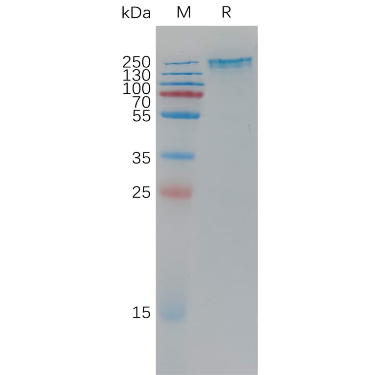 SDS-PAGE - Recombinant Human Sez6 Protein (6×His Tag) (A317779) - Antibodies.com