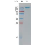 SDS-PAGE - Recombinant Human Sez6 Protein (6×His Tag) (A317779) - Antibodies.com
