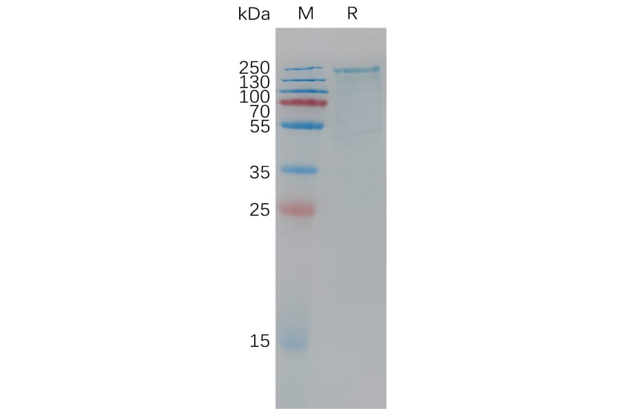 SDS-PAGE - Recombinant Human LRP6 Protein (6×His Tag) (A317780) - Antibodies.com
