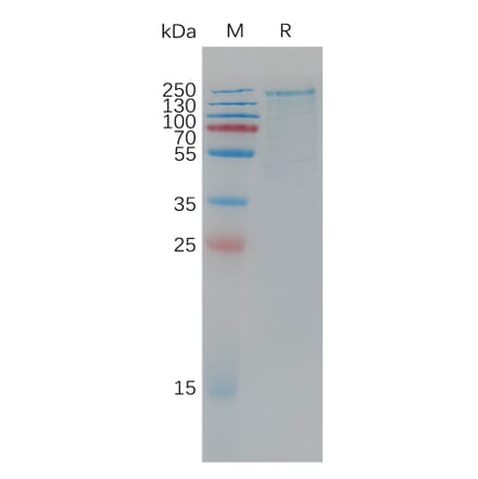 SDS-PAGE - Recombinant Human LRP6 Protein (6×His Tag) (A317780) - Antibodies.com