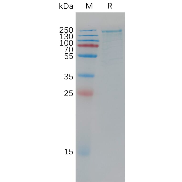 SDS-PAGE - Recombinant Human LRP6 Protein (6×His Tag) (A317780) - Antibodies.com