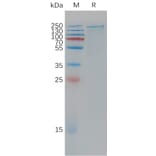 SDS-PAGE - Recombinant Human LRP6 Protein (6×His Tag) (A317780) - Antibodies.com