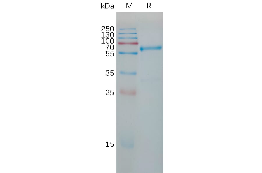 SDS-PAGE - Recombinant Human TIMP1 Protein (Fc Tag) (A317781) - Antibodies.com