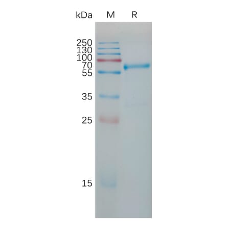 SDS-PAGE - Recombinant Human TIMP1 Protein (Fc Tag) (A317781) - Antibodies.com