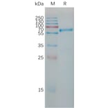 SDS-PAGE - Recombinant Human TIMP1 Protein (Fc Tag) (A317781) - Antibodies.com