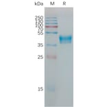 SDS-PAGE - Recombinant Human Orexin Receptor 1/Ox-1-R Protein (Fc Tag) (A317783) - Antibodies.com