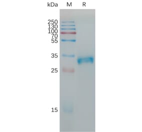 SDS-PAGE - Recombinant Human Claudin 6 Protein (Fc Tag) (A317784) - Antibodies.com