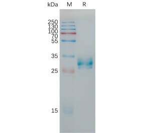 SDS-PAGE - Recombinant Human Claudin 6 Protein (Fc Tag) (A317785) - Antibodies.com