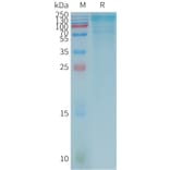 SDS-PAGE - Recombinant Human LGALS3BP Protein (3×Flag Tag) (A317786) - Antibodies.com