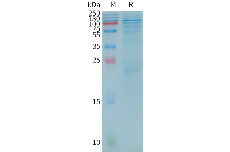 SDS-PAGE - Recombinant Human BTK Protein (3×Flag Tag) (A317787) - Antibodies.com