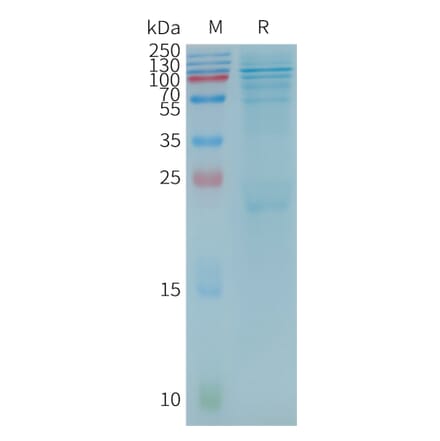 SDS-PAGE - Recombinant Human BTK Protein (3×Flag Tag) (A317787) - Antibodies.com
