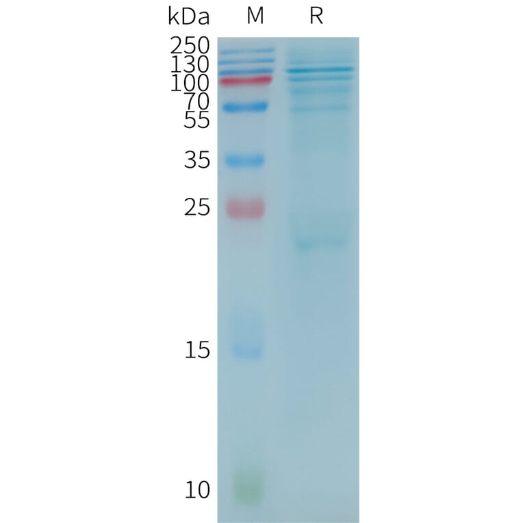 SDS-PAGE - Recombinant Human BTK Protein (3×Flag Tag) (A317787) - Antibodies.com