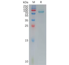 SDS-PAGE - Recombinant Human Frizzled 7 Protein (Fc Tag) (A317792) - Antibodies.com