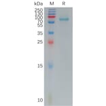 SDS-PAGE - Recombinant Human Frizzled 7 Protein (Fc Tag) (A317792) - Antibodies.com