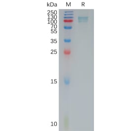 SDS-PAGE - Recombinant Human Periostin Protein (6×His Tag) (A317793) - Antibodies.com