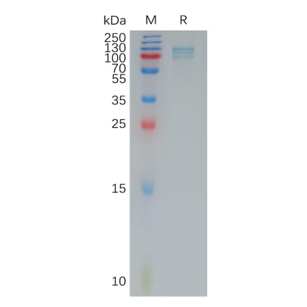 SDS-PAGE - Recombinant Human Periostin Protein (6×His Tag) (A317793) - Antibodies.com